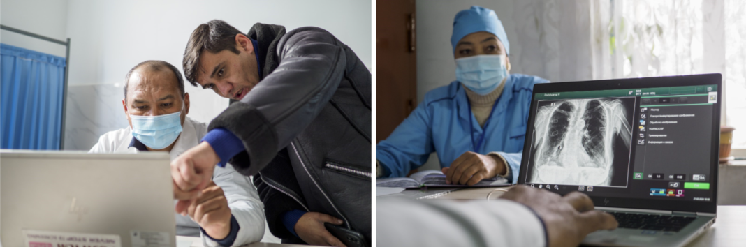 Utilization of AI linked with accurate detection of Tuberculosis