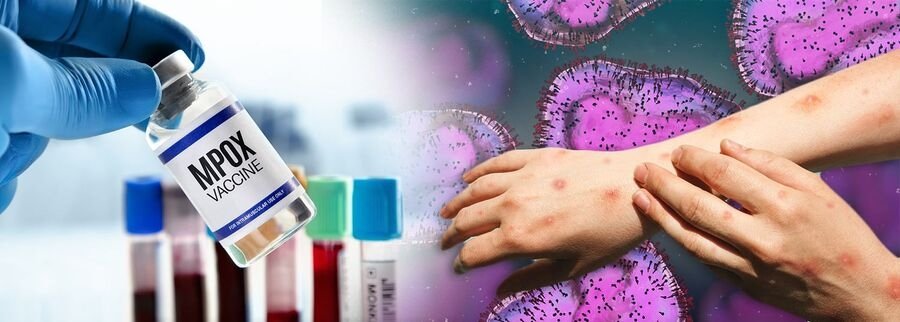 Germany Donated 100,000 Mpox Vaccinations To Stop African Outbreak